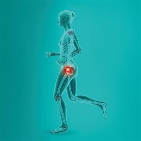 Private hip replacement Norwich .